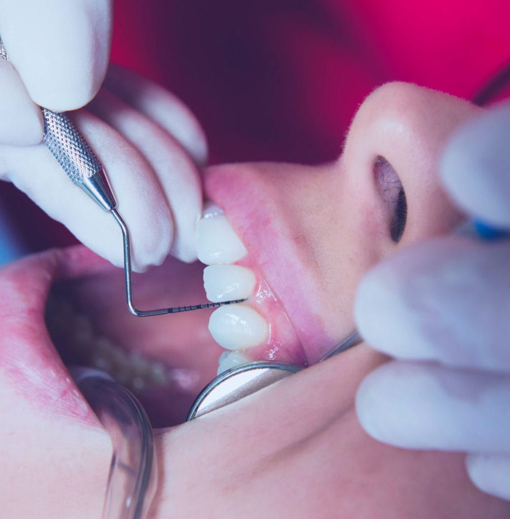 Parodontologia-Studi-Montagna Verona