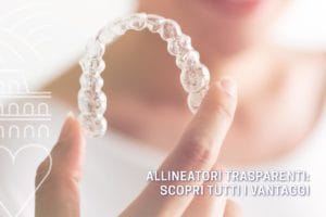 allineatori-trasparenti